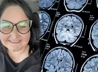 Baş Ağrısıyla Doktora Gitti, Hayatının Şokunu Yaşadı: 18 Aylık Ömrün Kaldı